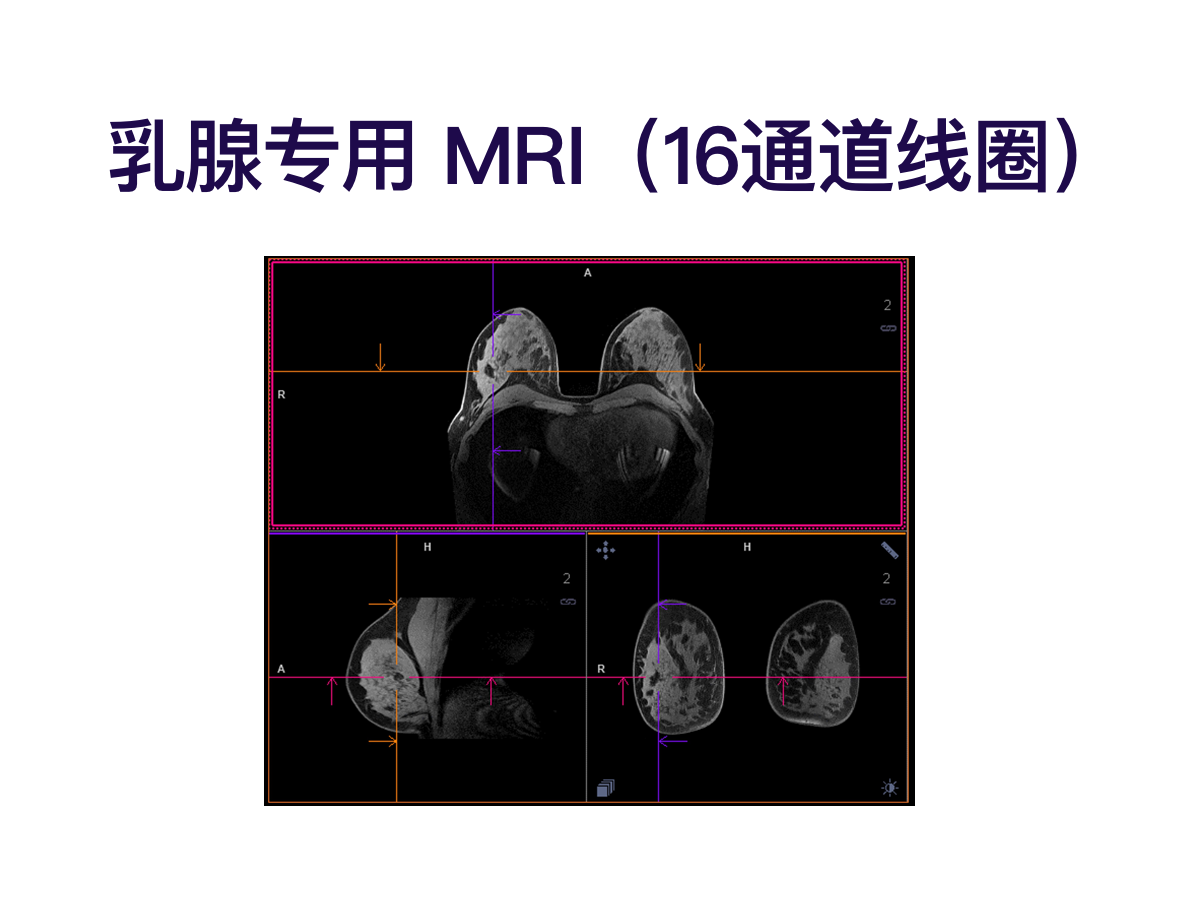 MRI-R